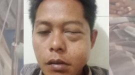 Foto. Moh Iskandar, Korban Penganiayaan 