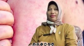 Foto. Lonjakan Kasus Campak di Sumenep Versi RSUD Moh Anwar Sumenep, Dr Erliyati.,M.Kes