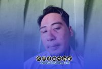 Foto. Korban penganiayaan di desa Saur-saibus kepulauan sapeken sumenep. 